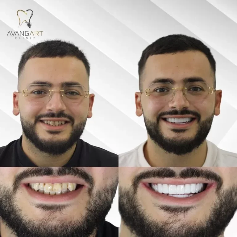 avangart-galeri-1 (2)