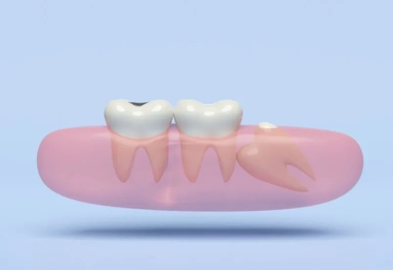 Day-By-Day-Wisdom-Teeth-Healing-Timeline