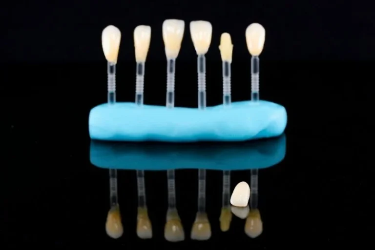 How-Much-Can-You-Save-on-Veneers-in-Turkey-An-In-Depth-Cost-Breakdown