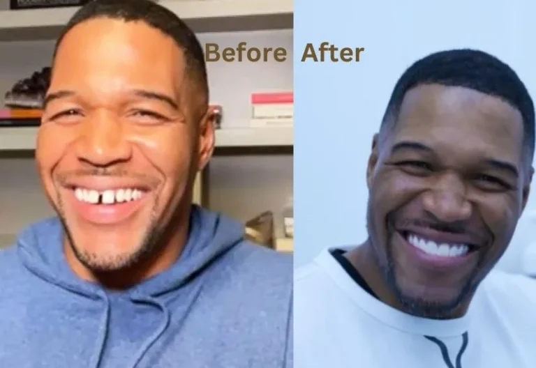 Michael-Strahan-Teeth