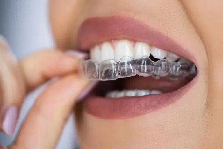 Mouth-guard-testing