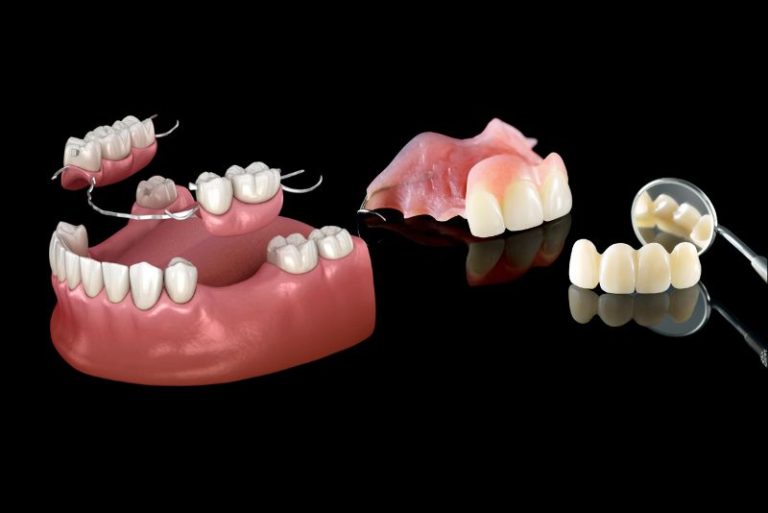 Partial Dentures In Turkey