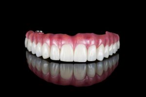 Snap-on Dentures