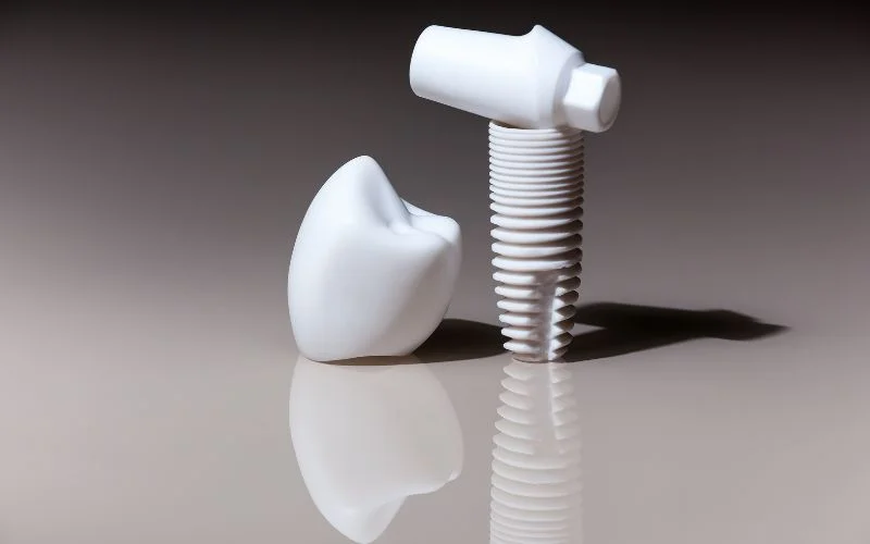 Top-Dental-Implant-Brands