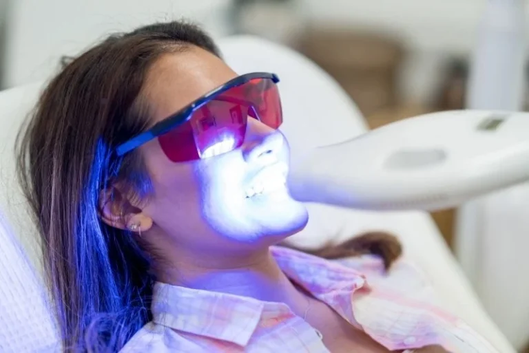 laser-teeth-whitening-process