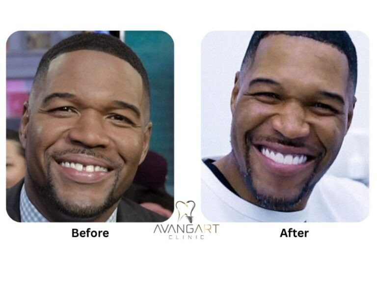 michael strahan gap