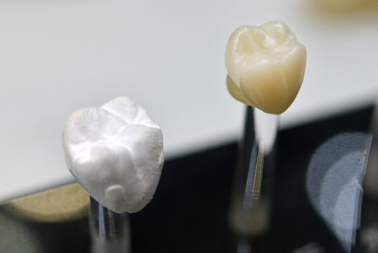 What Are CEREC Dental Crowns