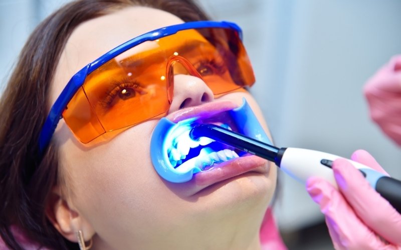 zoom teeth whitening cost