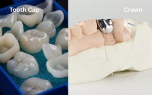 Difference Between Tooth Cap vs Crown