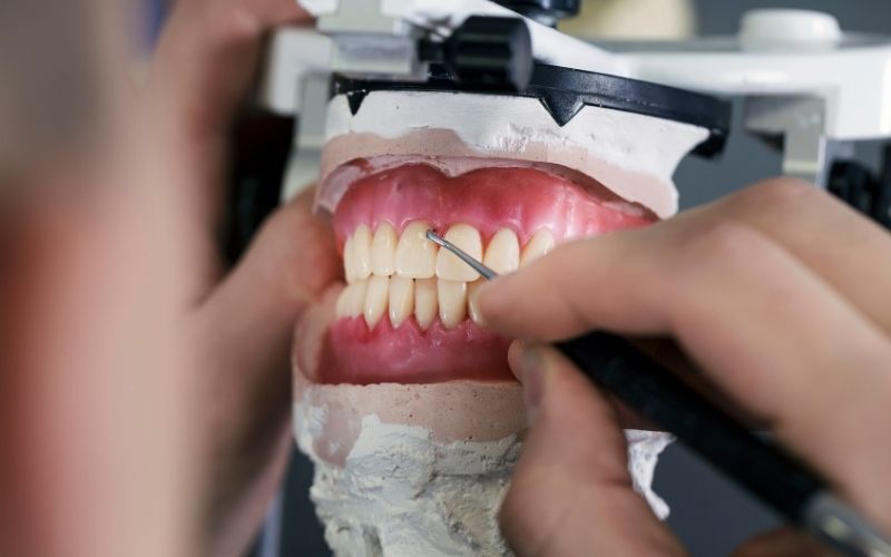 What is a dental prosthesis