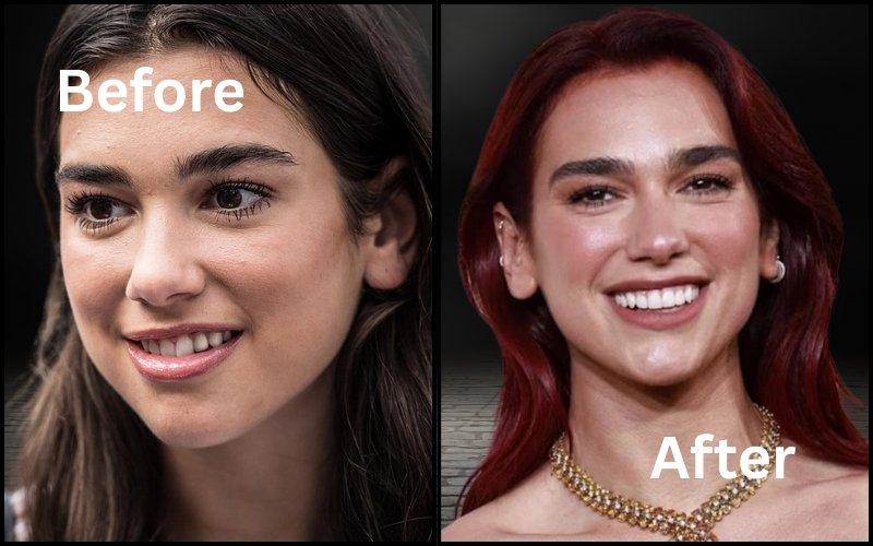 Dua Lipa Teeth Before and After