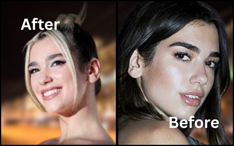 Dua Lipa smile Before and After