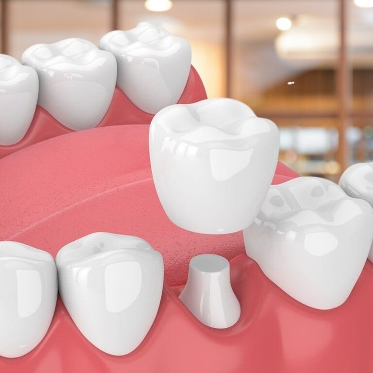 zirconium crowns look
