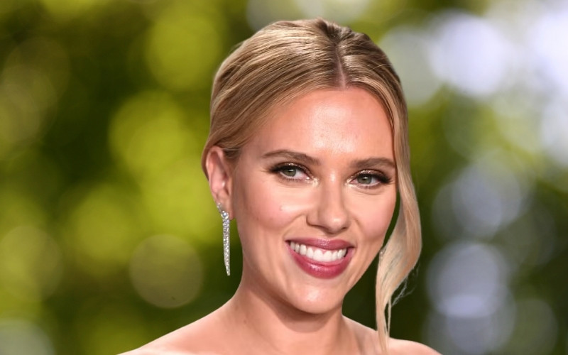 Scarlett Johansson veneers From Imperfection to Iconic Smile