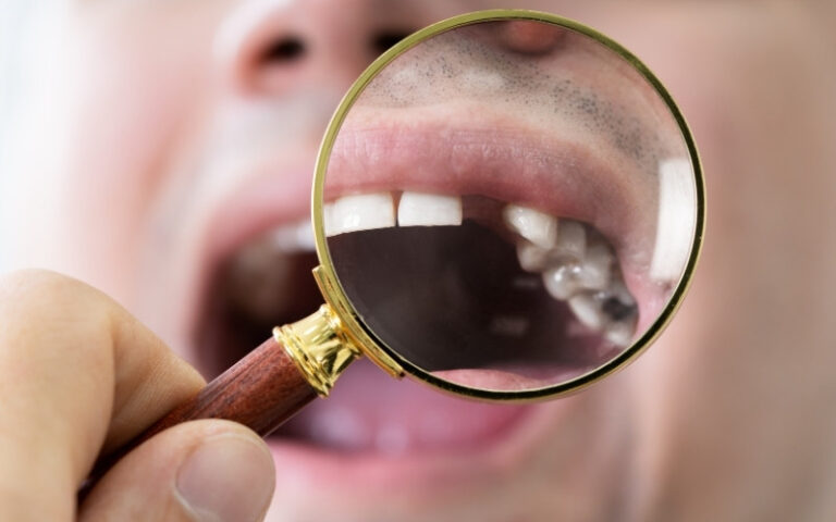What Are The Recommended Teeth Covers For Missing Teeth