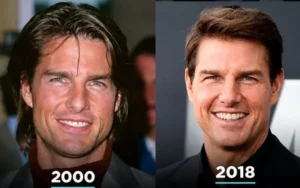 Tom Cruise Teeth: Timeline of the Most Famous Hollywood Smile