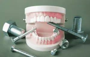 The 7-Day Turkey Dental Trip: A Daily Timeline for Full-Arch Implants
