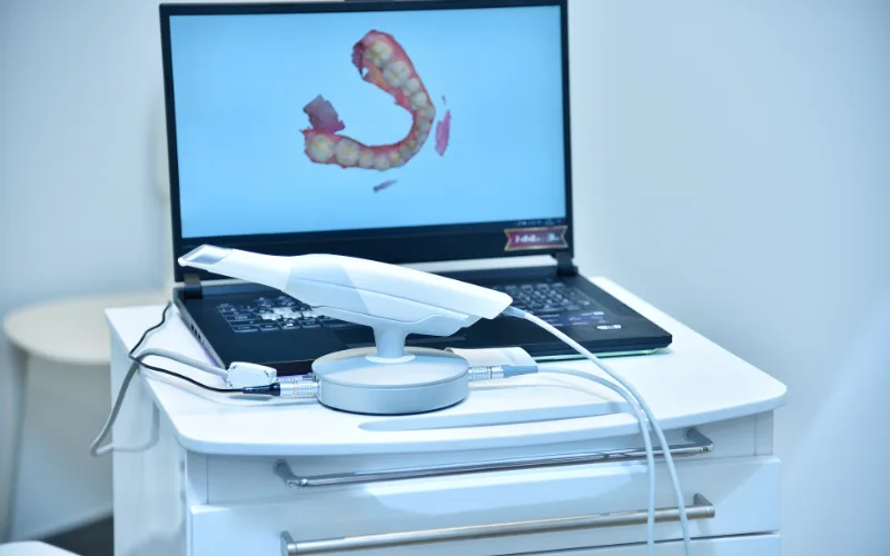 intraroral dental scanner