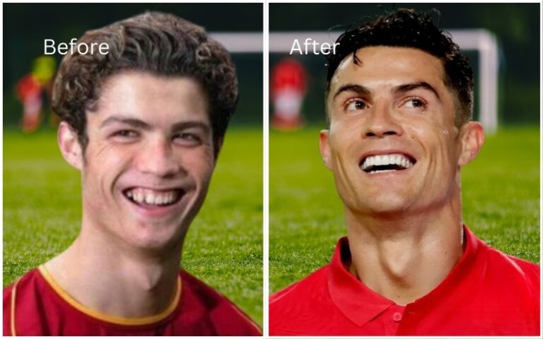 Ronaldo-dental-treatment