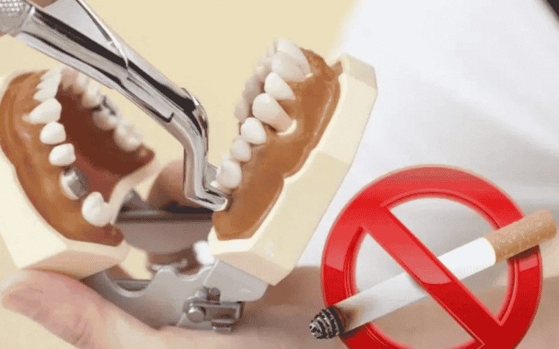 Tooth Extraction Aftercare and Smoking