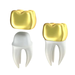 Gold Crowns